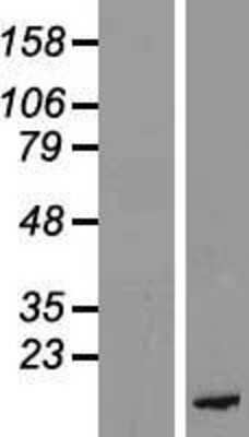 Western Blot: PKI-beta Overexpression Lysate [NBL1-14459]