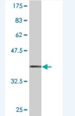 Western Blot: PKIG Antibody (2D9) [H00011142-M10]