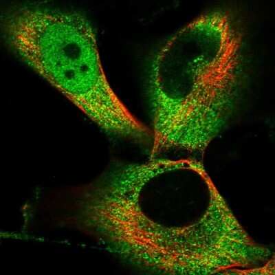 Immunocytochemistry/ Immunofluorescence: PKIG Antibody [NBP1-86212]