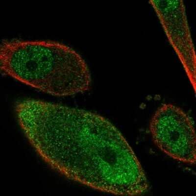 Immunocytochemistry/ Immunofluorescence: PKIG Antibody [NBP2-56126]