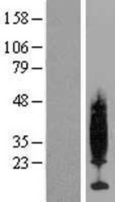 Western Blot: PKIG Overexpression Lysate [NBP2-07538]