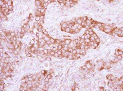 Immunohistochemistry-Paraffin: PKLR Antibody [NBP2-20027]