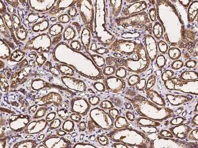 Immunohistochemistry-Paraffin: PKLR Antibody [NBP2-97071]