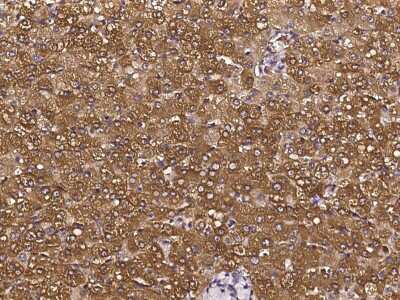 Immunohistochemistry-Paraffin: PKLR Antibody [NBP2-97071]