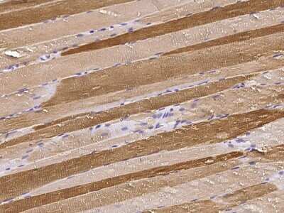 Immunohistochemistry-Paraffin: PKLR Antibody [NBP2-97071]