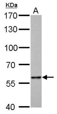 Western Blot: PKLR Antibody [NBP1-32314]