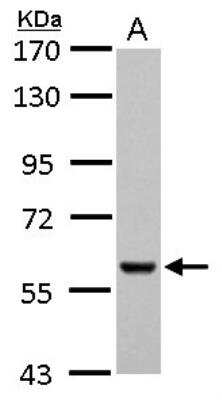 Western Blot: PKLR Antibody [NBP1-32314]