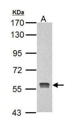 Western Blot: PKLR Antibody [NBP2-20027]