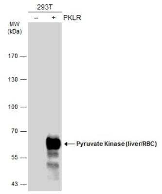 Western Blot: PKLR Antibody [NBP2-20027]