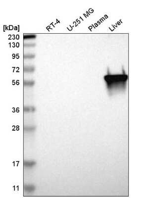 Western Blot: PKLR Antibody [NBP2-58892]