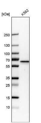 Western Blot: PKLR Antibody [NBP2-58892]