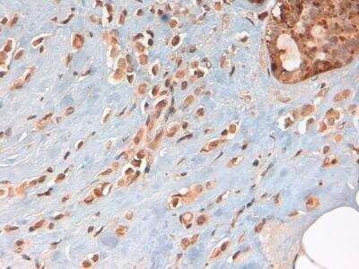 Immunohistochemistry-Paraffin: PKM1 Antibody - BSA Free [NBP2-14833]