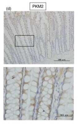 Immunohistochemistry: PKM2 Antibody - BSA Free [NBP1-48308]