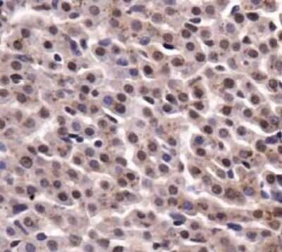 Immunohistochemistry: PKM2 Antibody - BSA Free [NBP1-48308]