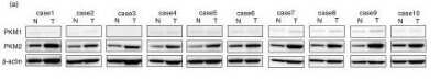 Western Blot: PKM2 AntibodyBSA Free [NBP1-48308]