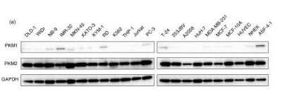 Western Blot: PKM2 AntibodyBSA Free [NBP1-48308]