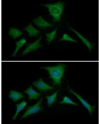 Immunocytochemistry/ Immunofluorescence: PKM2 Antibody (1B10) - BSA Free [NBP2-42686]
