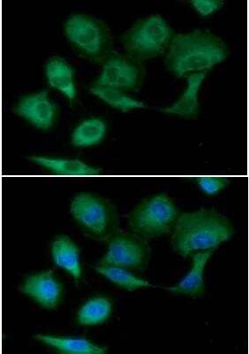 Immunocytochemistry/ Immunofluorescence: PKM2 Antibody (1B10) - BSA Free [NBP2-42686]