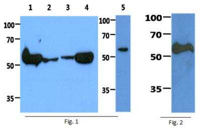 Western Blot: PKM2 Antibody (1B10)BSA Free [NBP2-42686]