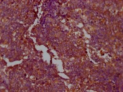 Immunohistochemistry: PKM2 Antibody (7B2) [NBP3-15230]