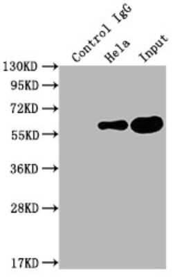 Immunoprecipitation: PKM2 Antibody (7B2) [NBP3-15230]