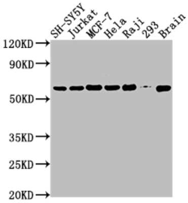 Western Blot: PKM2 Antibody (7B2) [NBP3-15230]