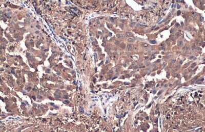Immunohistochemistry-Paraffin: PKM2 Antibody (GT1810) [NBP3-13632]