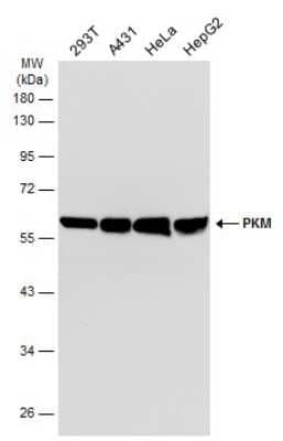 Western Blot: PKM2 Antibody (GT1810) [NBP3-13632]