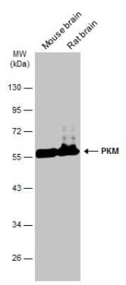 Western Blot: PKM2 Antibody (GT1810) [NBP3-13632]