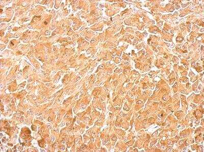 Immunohistochemistry-Paraffin: PKM2 Antibody [NBP2-19852]
