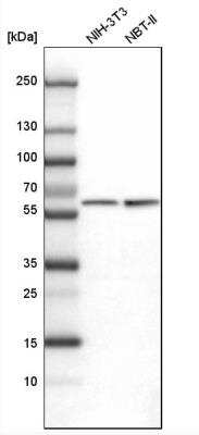 Western Blot: PKM2 Antibody [NBP1-82487]