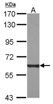 Western Blot: PKM2 Antibody [NBP2-19852]