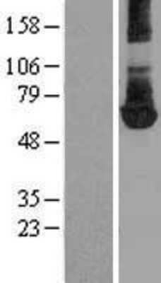 Western Blot: PKM2 Overexpression Lysate [NBL1-14462]