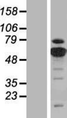 Western Blot: PKM2 Overexpression Lysate [NBP2-04863]