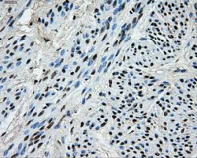 Immunohistochemistry-Paraffin: PKMYT1 Antibody (OTI5E1) [NBP2-02275]