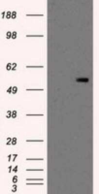 Western Blot: PKMYT1 Antibody (OTI5E1) [NBP2-02275]