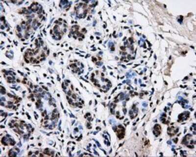 Immunohistochemistry: PKMYT1 Antibody (OTI5E1) - Azide and BSA Free [NBP2-73452]