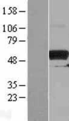 Western Blot: PKMYT1 Overexpression Lysate [NBL1-14463]