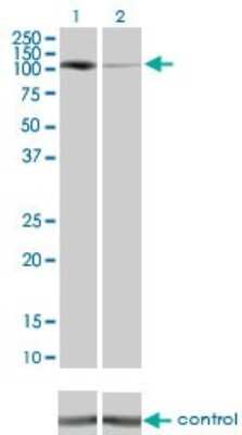 Western Blot: PKN1 Antibody (1B10) [H00005585-M01]