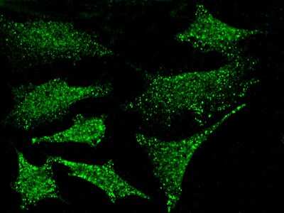 Immunocytochemistry/ Immunofluorescence: PKN1 Antibody [NBP2-98761]