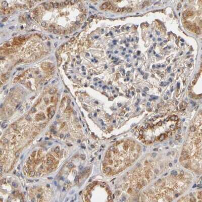 Immunohistochemistry-Paraffin: PKN1 Antibody [NBP1-85301]