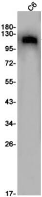 Western Blot: PKN1 Antibody (S09-2I4) [NBP3-19741]