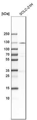 Western Blot: PKN1 Antibody [NBP1-85301]