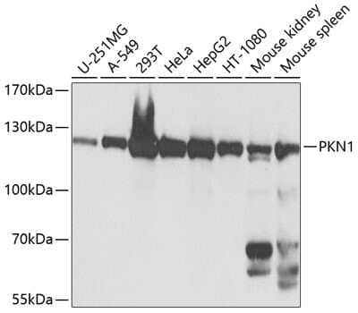 Western Blot: PKN1 AntibodyBSA Free [NBP2-95113]