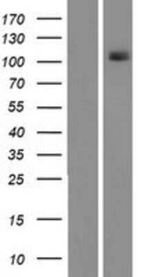 Western Blot: PKN1 Overexpression Lysate [NBP2-08073]