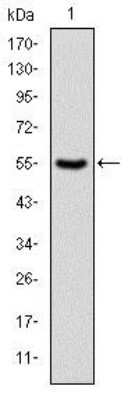 Western Blot: PKN2 Antibody (1D1)BSA Free [NBP2-37573]