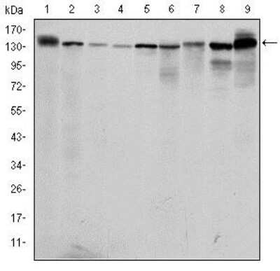 Western Blot: PKN2 Antibody (1D1)BSA Free [NBP2-37573]