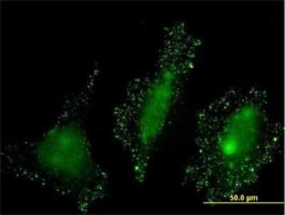 Immunocytochemistry/ Immunofluorescence: PKN2 Antibody (3A7) [H00005586-M01]