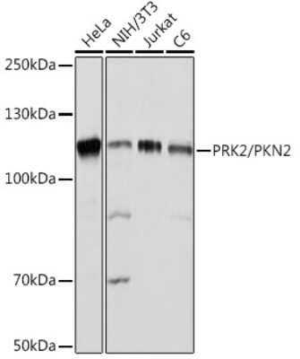 Western Blot: PKN2 Antibody (5O2G6) [NBP3-15891]