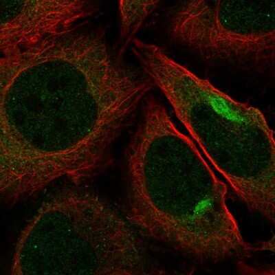 Immunocytochemistry/ Immunofluorescence: PKN2 Antibody [NBP2-68736]